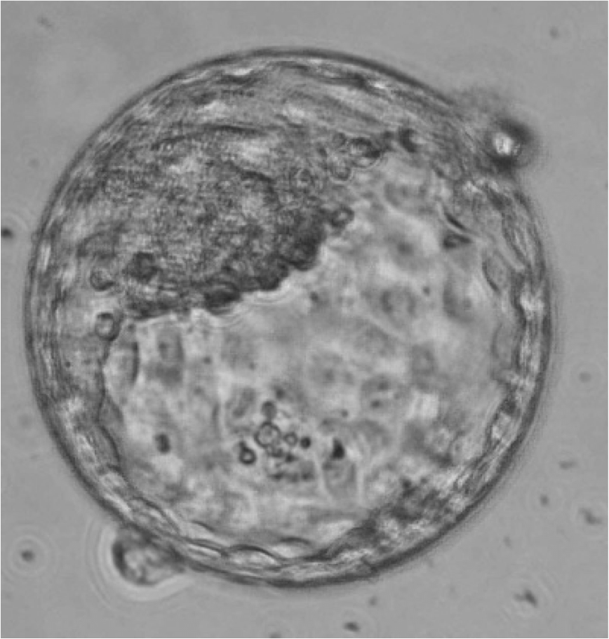 The ethics of changing genes in the embryo | Eurostemcell