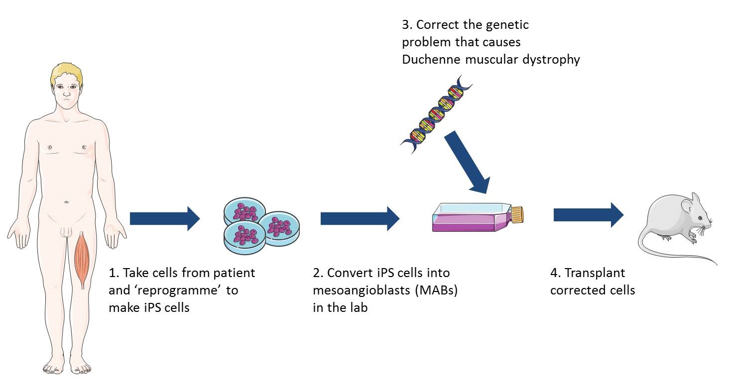 Diagram explaining reprogramming and cell therapies of Duchenne muscular dystrophy