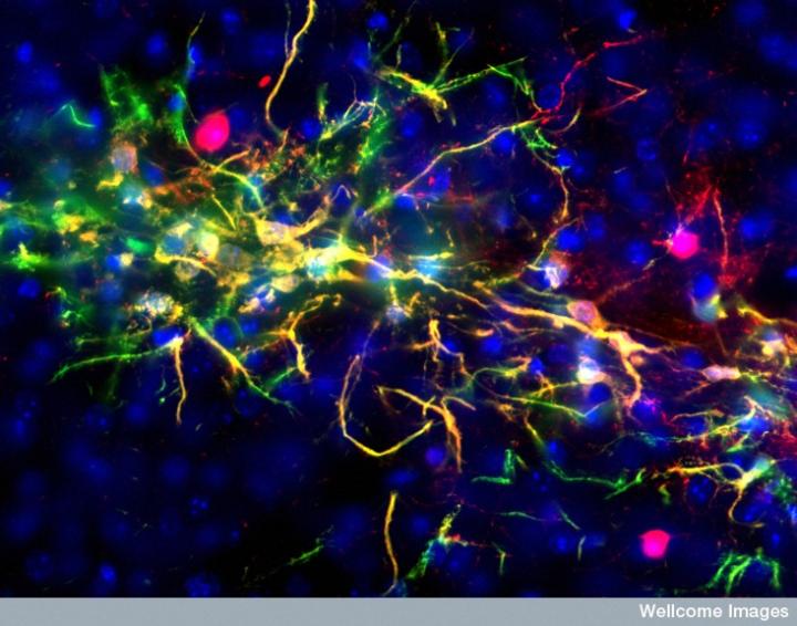 Células madre neuronales