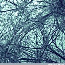 Image of neurons grown from embryonic stem cells in the lab