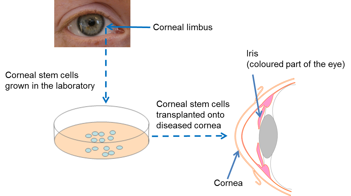 stem cell technology to cure eye diseases research paper