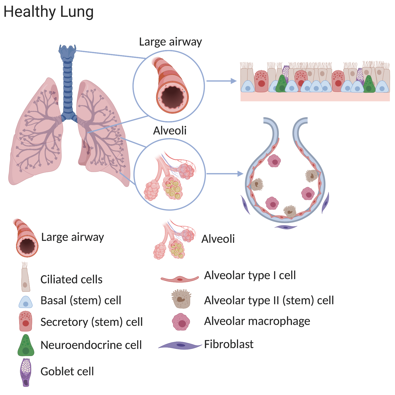 Lung Cancer Cell Diagram