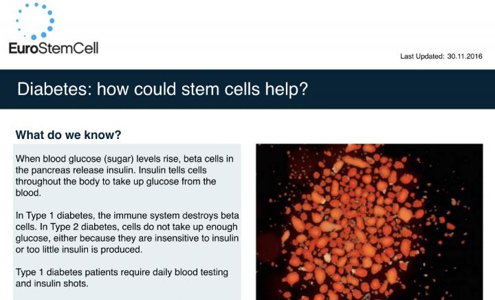 Diabetes how could stem cells help Eurostemcell